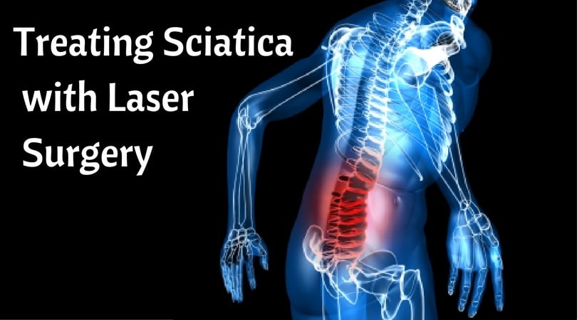 How Is Sciatica Treated With Laser Surgery?